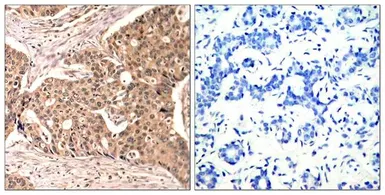 Anti-Paxillin (phospho Tyr118) antibody used in IHC (Paraffin sections) (IHC-P). GTX50155