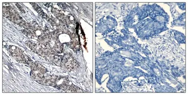 Anti-p53 (phospho Ser6) antibody used in IHC (Paraffin sections) (IHC-P). GTX50157