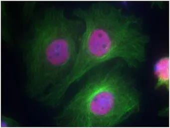 Anti-p53 (phospho Ser15) antibody used in Immunocytochemistry/ Immunofluorescence (ICC/IF). GTX50158