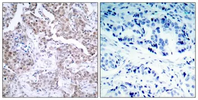 Anti-p53 (phospho Ser15) antibody used in IHC (Paraffin sections) (IHC-P). GTX50158