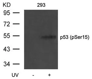 Anti-p53 (phospho Ser15) antibody used in Western Blot (WB). GTX50158