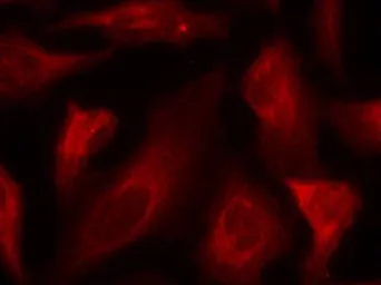 Anti-p53 (phospho Ser33) antibody used in Immunocytochemistry/ Immunofluorescence (ICC/IF). GTX50161