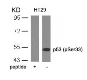 Anti-p53 (phospho Ser33) antibody used in Western Blot (WB). GTX50161