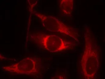 Anti-p53 (phospho Ser46) antibody used in Immunocytochemistry/ Immunofluorescence (ICC/IF). GTX50163