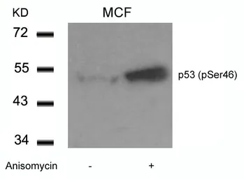 Anti-p53 (phospho Ser46) antibody used in Western Blot (WB). GTX50163