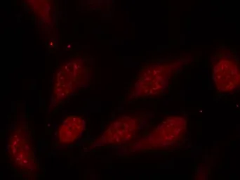 Anti-p53 (phospho Ser315) antibody used in Immunocytochemistry/ Immunofluorescence (ICC/IF). GTX50164