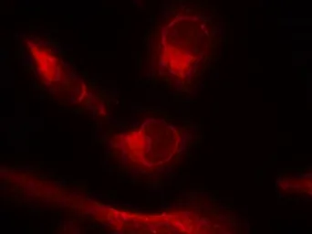 Anti-Tau (phospho Ser356) antibody used in Immunocytochemistry/ Immunofluorescence (ICC/IF). GTX50165