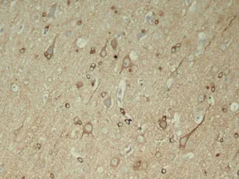 Anti-Tau (phospho Ser396) antibody used in IHC (Paraffin sections) (IHC-P). GTX50166
