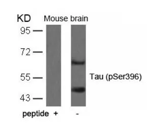 Anti-Tau (phospho Ser396) antibody used in Western Blot (WB). GTX50166