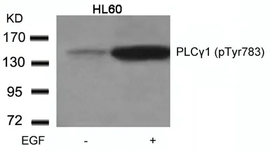 Anti-PLCG1 (phospho Tyr783) antibody used in Western Blot (WB). GTX50167