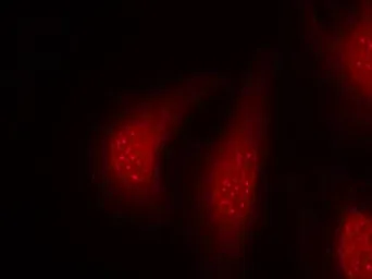 Anti-p90 RSK1 (phospho Thr359) antibody used in Immunocytochemistry/ Immunofluorescence (ICC/IF). GTX50169