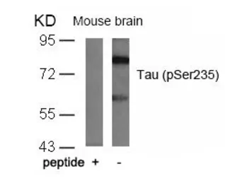 Anti-Tau (phospho Ser235) antibody used in Western Blot (WB). GTX50170