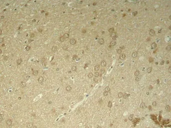 Anti-Tau (phospho Thr205) antibody used in IHC (Paraffin sections) (IHC-P). GTX50172