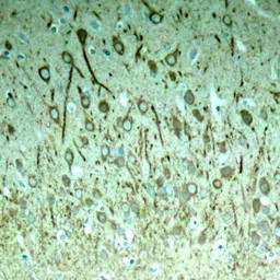 Anti-Tau (phospho Thr231) antibody used in IHC (Paraffin sections) (IHC-P). GTX50174