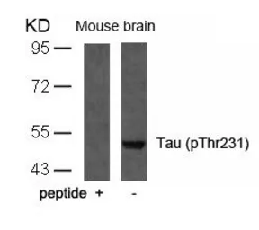 Anti-Tau (phospho Thr231) antibody used in Western Blot (WB). GTX50174