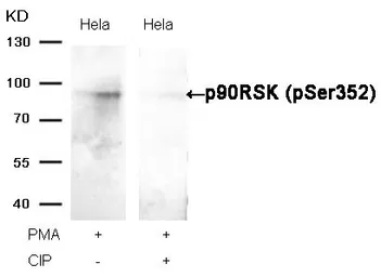 Anti-p90 RSK1 (phospho Ser363) antibody used in Western Blot (WB). GTX50177