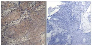 Anti-Myosin Light Chain 2 (phospho Ser19) antibody used in IHC (Paraffin sections) (IHC-P). GTX50178