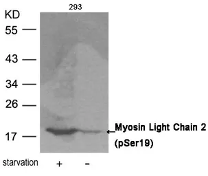 Anti-Myosin Light Chain 2 (phospho Ser19) antibody used in Western Blot (WB). GTX50178