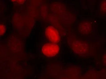 Anti-FOXO1 (phospho Ser256) antibody used in Immunocytochemistry/ Immunofluorescence (ICC/IF). GTX50179