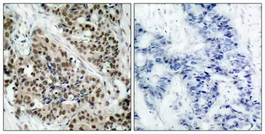 Anti-FOXO1 (phospho Ser256) antibody used in IHC (Paraffin sections) (IHC-P). GTX50179