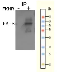 Anti-FOXO1 (phospho Ser256) antibody used in Immunoprecipitation (IP). GTX50179