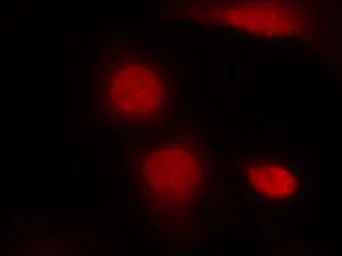 Anti-Androgen Receptor (phospho Ser213) antibody used in Immunocytochemistry/ Immunofluorescence (ICC/IF). GTX50182