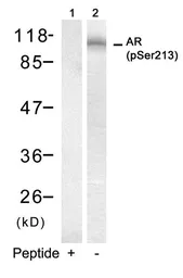 Anti-Androgen Receptor (phospho Ser213) antibody used in Western Blot (WB). GTX50182