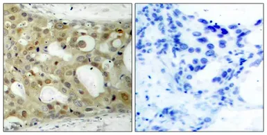Anti-Androgen Receptor (phospho Ser650) antibody used in IHC (Paraffin sections) (IHC-P). GTX50183