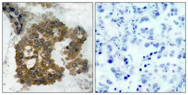 Anti-AKT (phospho Ser473) antibody used in IHC (Paraffin sections) (IHC-P). GTX50186