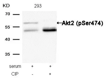 Anti-AKT (phospho Ser473) antibody used in Western Blot (WB). GTX50186