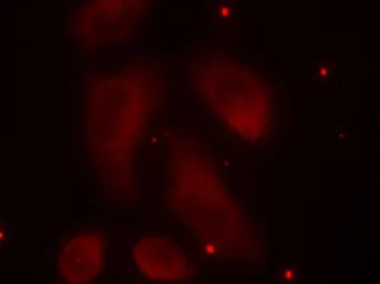 Anti-LIMK1 (phospho Thr508) + LIMK2 (phospho Thr505) antibody used in Immunocytochemistry/ Immunofluorescence (ICC/IF). GTX50187