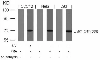 Anti-LIMK1 (phospho Thr508) + LIMK2 (phospho Thr505) antibody used in Western Blot (WB). GTX50187