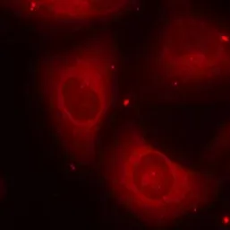 Anti-LIM kinase 2 (phospho Thr505) antibody used in Immunocytochemistry/ Immunofluorescence (ICC/IF). GTX50188