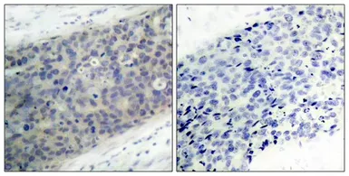 Anti-LIM kinase 2 (phospho Thr505) antibody used in IHC (Paraffin sections) (IHC-P). GTX50188