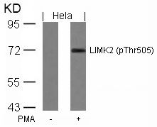 Anti-LIM kinase 2 (phospho Thr505) antibody used in Western Blot (WB). GTX50188