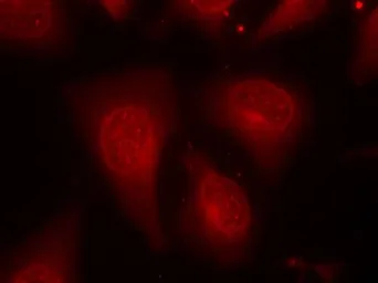 Anti-HDAC8 (phospho Ser39) antibody used in Immunocytochemistry/ Immunofluorescence (ICC/IF). GTX50189