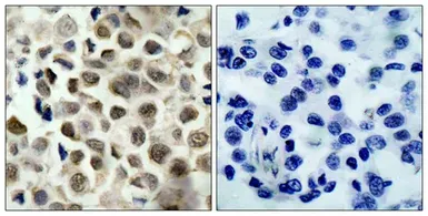 Anti-HDAC8 (phospho Ser39) antibody used in IHC (Paraffin sections) (IHC-P). GTX50189