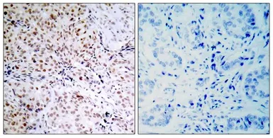 Anti-Rb (phospho Ser795) antibody used in IHC (Paraffin sections) (IHC-P). GTX50191