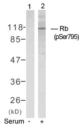 Anti-Rb (phospho Ser795) antibody used in Western Blot (WB). GTX50191