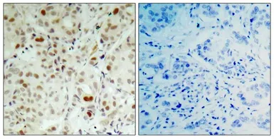 Anti-Rb (phospho Ser807) antibody used in IHC (Paraffin sections) (IHC-P). GTX50192