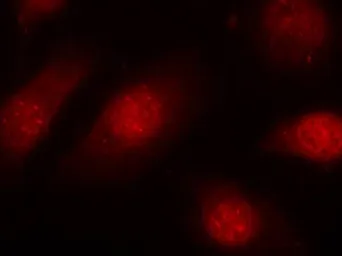 Anti-Rb (phospho Ser780) antibody used in Immunocytochemistry/ Immunofluorescence (ICC/IF). GTX50193