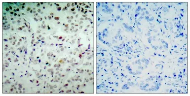 Anti-Rb (phospho Ser780) antibody used in IHC (Paraffin sections) (IHC-P). GTX50193