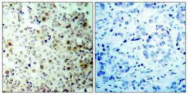 Anti-CDK2 (phospho Thr160) antibody used in IHC (Paraffin sections) (IHC-P). GTX50194