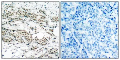 Anti-FOXO4 (phospho Ser197) antibody used in IHC (Paraffin sections) (IHC-P). GTX50197