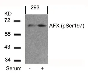 Anti-FOXO4 (phospho Ser197) antibody used in Western Blot (WB). GTX50197