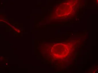 Anti-Cofilin 1 (phospho Ser3) antibody used in Immunocytochemistry/ Immunofluorescence (ICC/IF). GTX50199