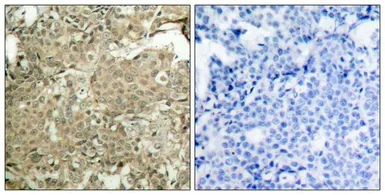 Anti-Cofilin 1 (phospho Ser3) antibody used in IHC (Paraffin sections) (IHC-P). GTX50199