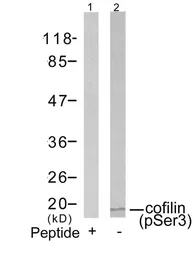 Anti-Cofilin 1 (phospho Ser3) antibody used in Western Blot (WB). GTX50199