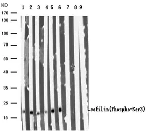 Anti-Cofilin 1 (phospho Ser3) antibody used in Western Blot (WB). GTX50199