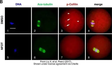 Anti-Cofilin 1 (phospho Ser3) antibody used in Immunocytochemistry/ Immunofluorescence (ICC/IF). GTX50199